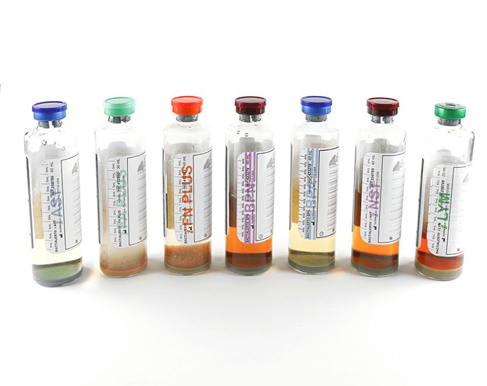 BACT/ALERT® Culture Media Bottles | Pioneering Diagnostics